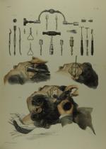 BOURGERY, BERNARD, JACOB. Anatomie de l'homme.Guérin, 1866. 3 volumes grand...