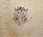 E. RAVET (actif 1870-1880)Microphotographie, acarius, diatomé, vers 18773 tirages d'époque.Timbre...